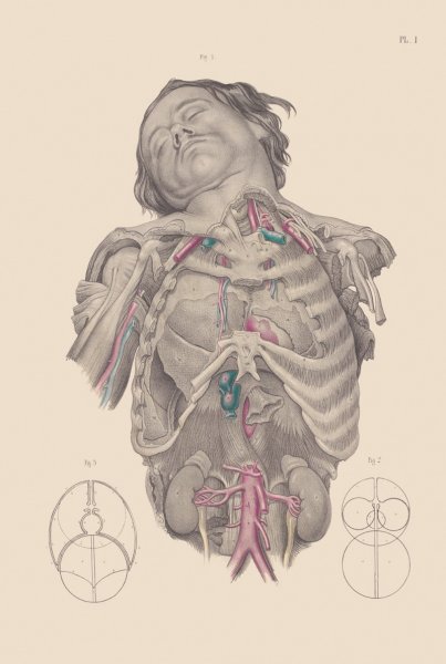 大卫·卡拉丁被解剖图片